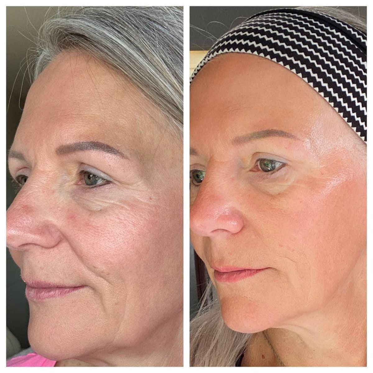 Elevate Your Skincare,